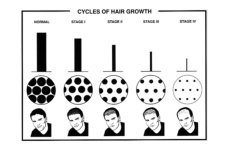 XP - UP Hair Growth Shampoo - 300ml photo