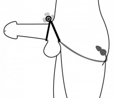 Prostatic Play - Voyager 震動陰莖環及肛門刺激器 - 黑色 照片
