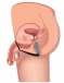 Prostatic Play - 前列腺刺激器与阴茎及睾丸环 - 黑色 照片-4