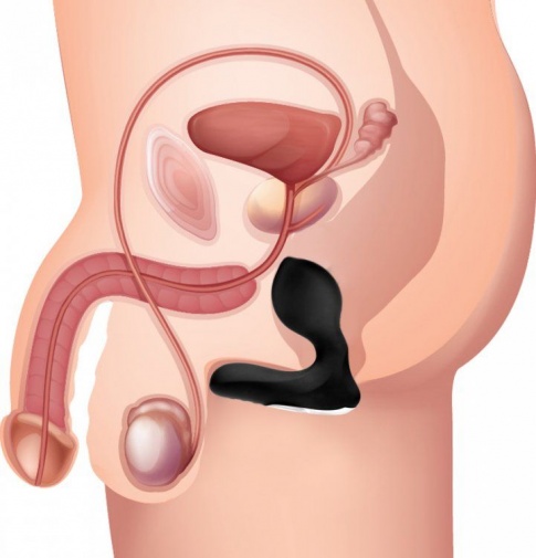 Prostatic Play - 充气式 12模式前列腺刺激器 - 黑色 照片